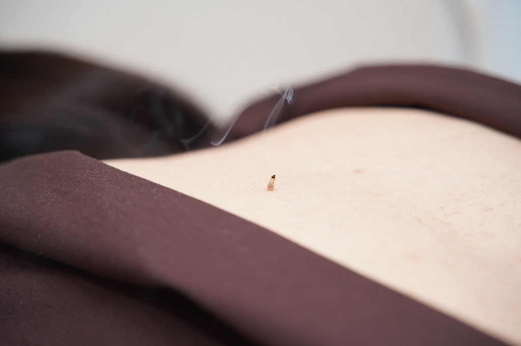 はり・お灸初心者さんも安心